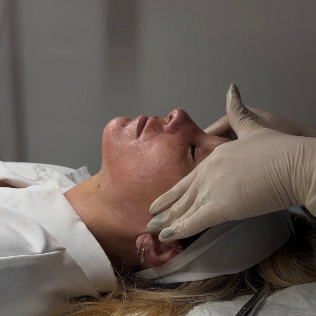 Clinical Peel Pro + LED Light Therapy